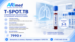 T-SPOT.TB в Санкт-Петербурге: анализ крови на туберкулез без облучения